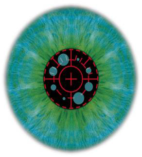 Excimerlaser Technik-Update